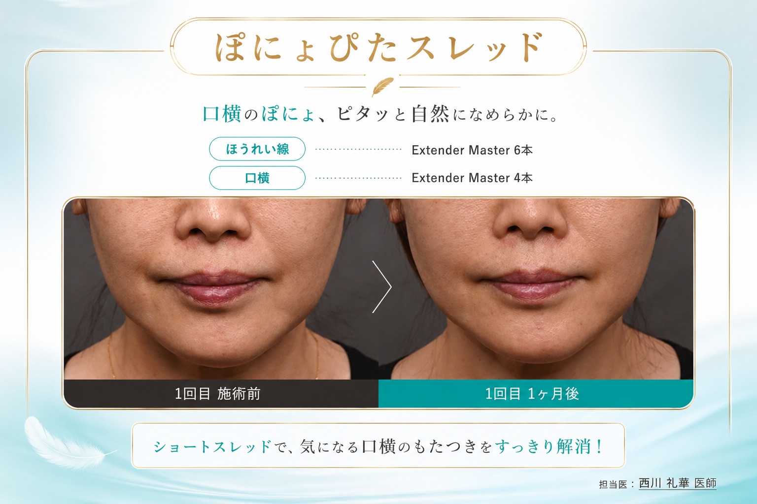 ぽにょっとした皮膚が気になる方へおすすめ！