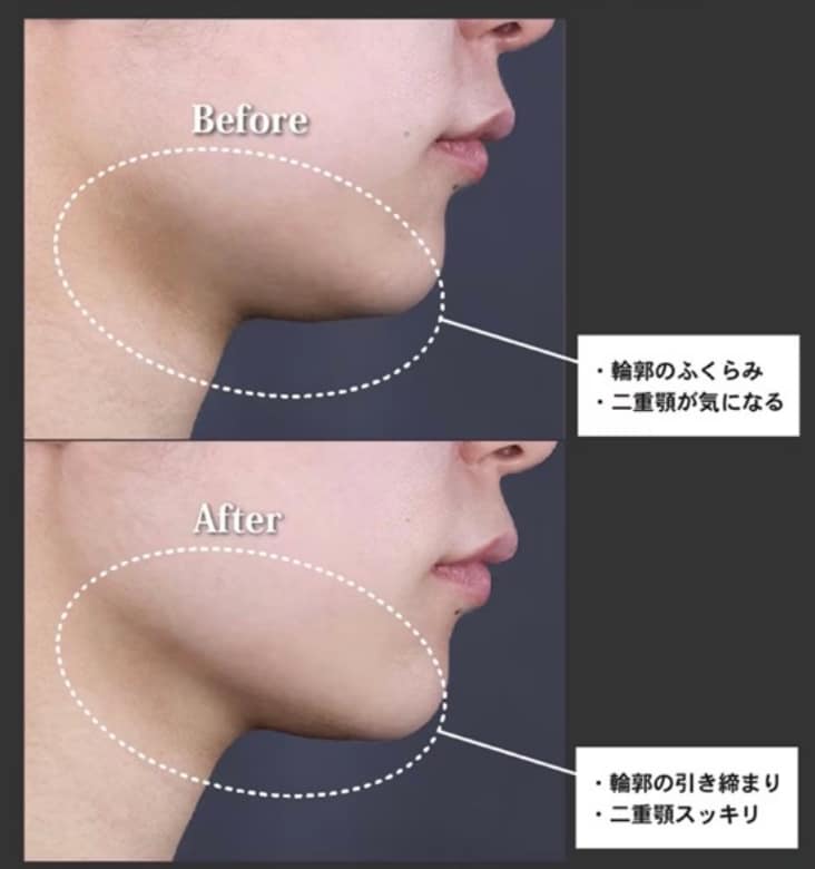 フェイスラインに影ができてる！