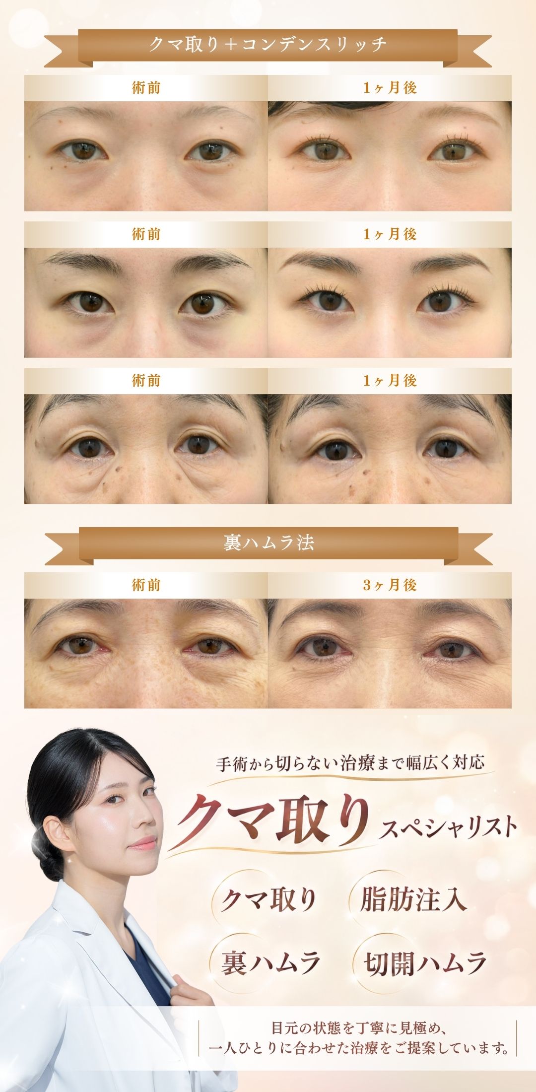 【新潟でクマ治療】名医 田中真緒医師のクマ取り・若返り術