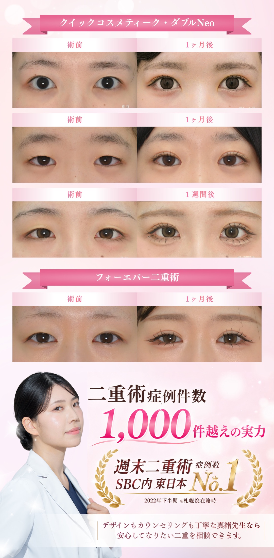 【新潟で二重整形】名医 田中真緒医師の二重術
