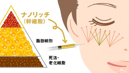 ナノリッチ