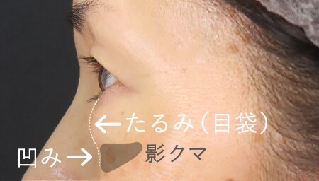 ふくらみと凹みが混在している人