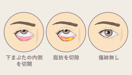 実際の施術方法