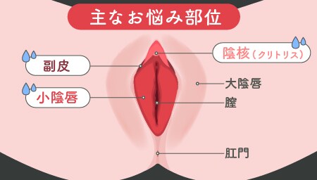 お悩み部位