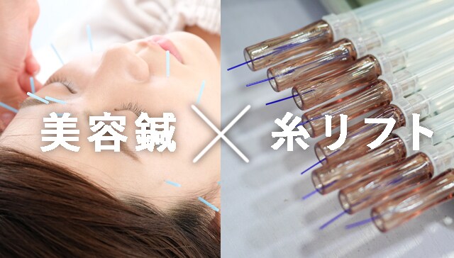 【美容鍼のような糸リフト】うるおいコラーゲンリフト