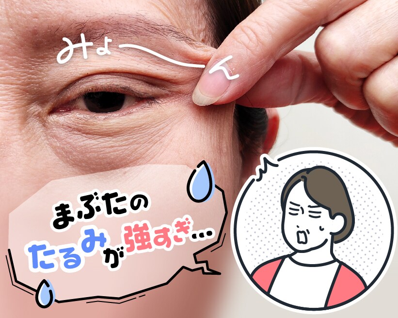 西葛西院で若返る二重切開法！年齢で諦めないミドル世代の為の二重術！