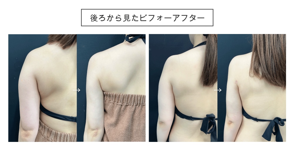 Behind