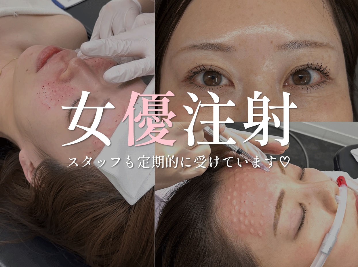 兵庫県西宮市｜「リジュラン」と「ボトックス」を組み合わせた女優注射💉 スタッフも定期的に打っています！