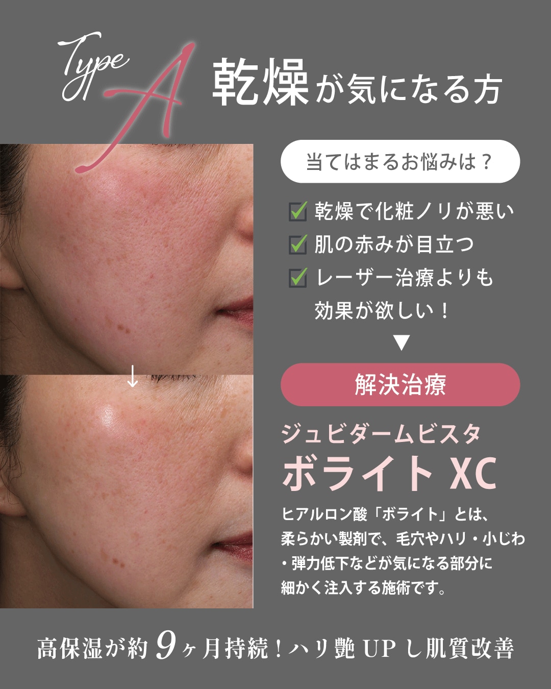 タイプAさん