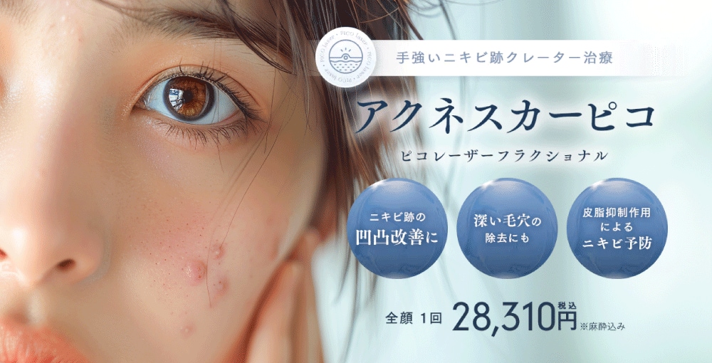 アクネスカーピコ