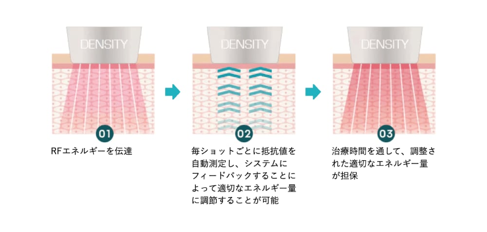 ②肌の状態を都度確認し、均一なエネルギーを照射！