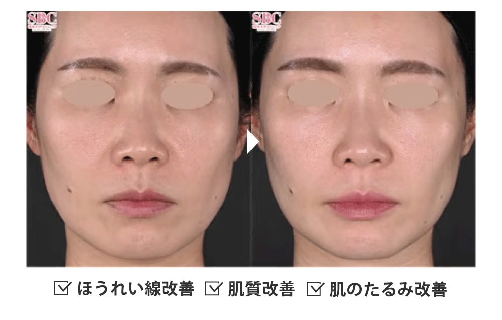 圧倒的な効果実感