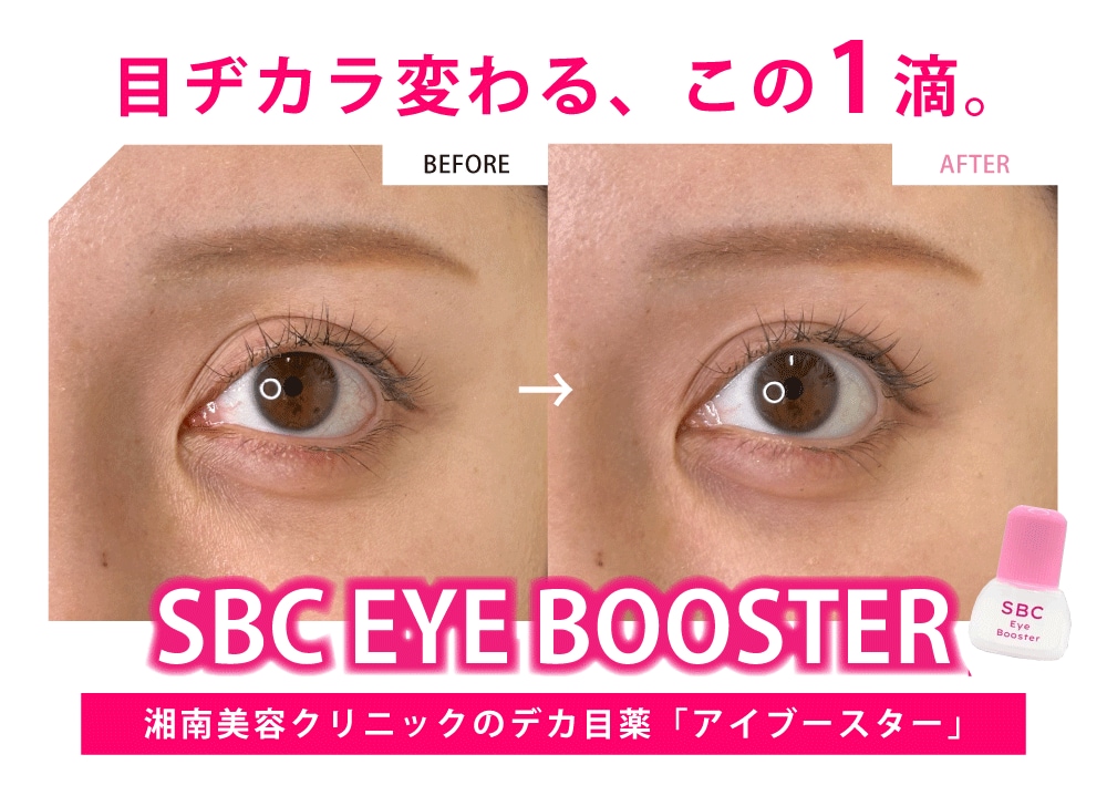 【湘南の医療用点眼薬】「SBCアイブースター」導入してます｜兵庫県 西宮北口院