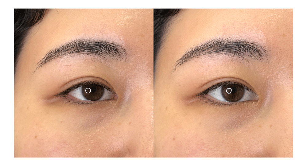 <b>白目部分の拡大</b>( 左がBEFORE / 右がAFTER )