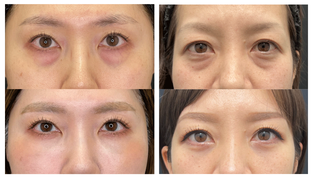 症例実績と仕上がりの自然さに定評