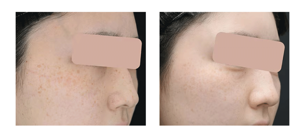 ✅ 圧倒的な症例件数