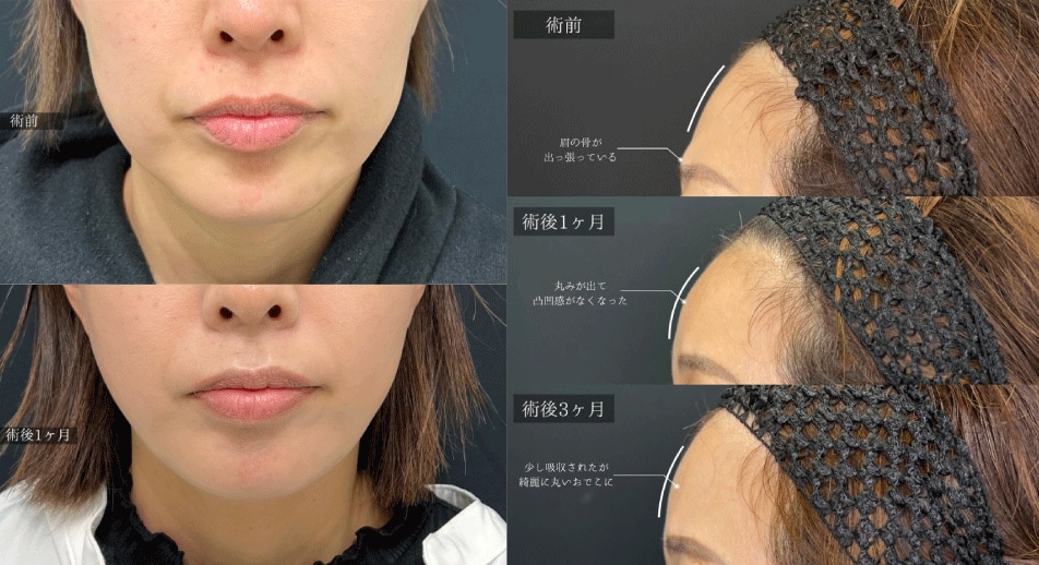 ✅ 若返り施術全般が得意