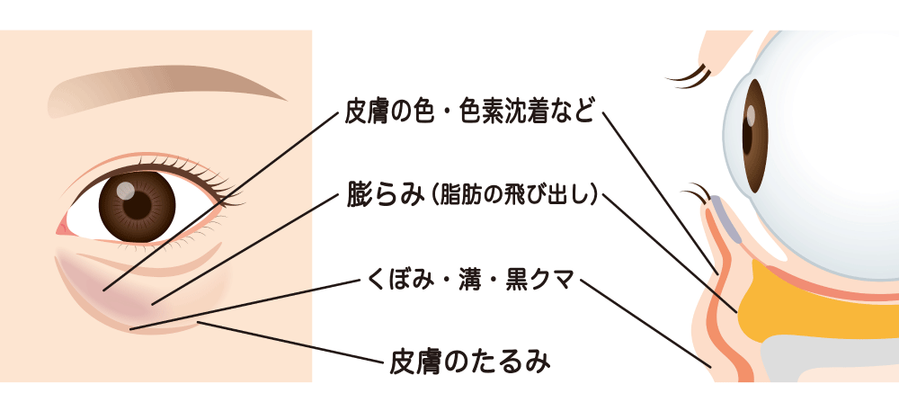脱脂だけ？ 注入も必要？