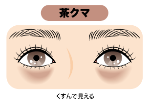 ✅ 茶クマ＝紫外線対策や保湿ケア