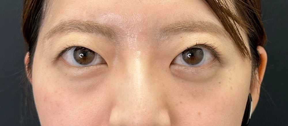 気になる老けみえ顔...