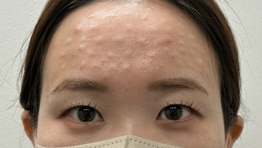 <b>◆ 1時間後</b>