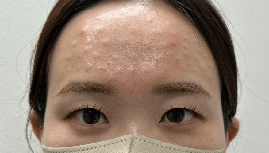 <b>◆ 2時間後</b>