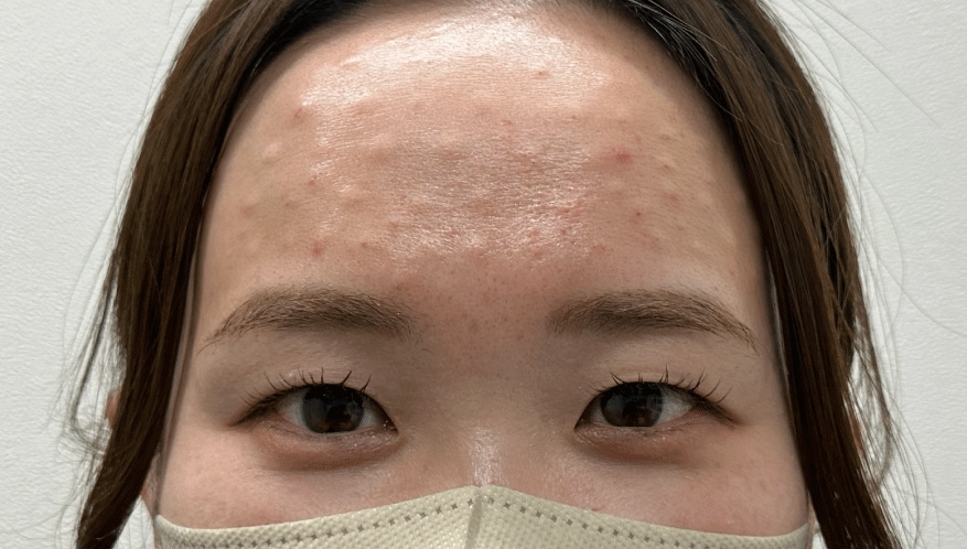 <b>◆ 3時間後</b>