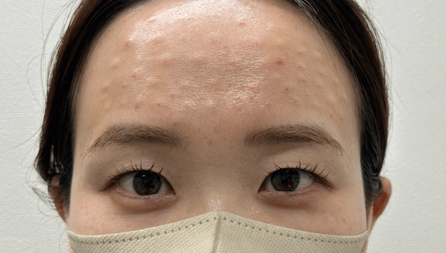 <b>◆ 5時間後</b>