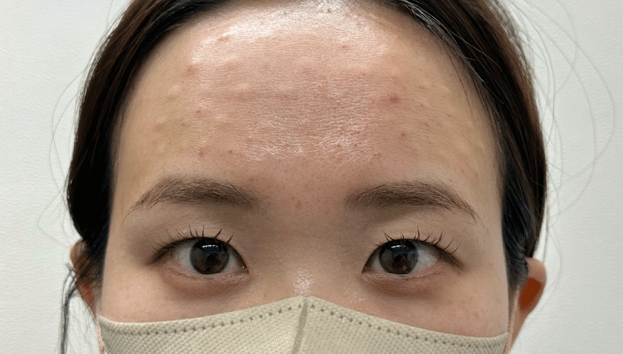 <b>◆ 7時間後</b>