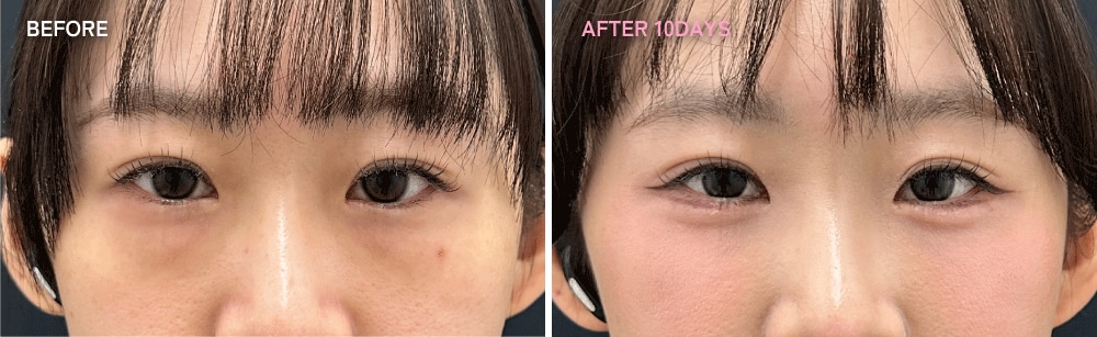 24歳の西北コンシェルジュ