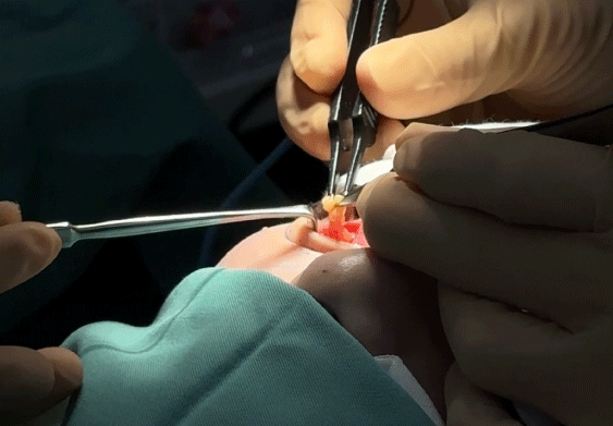 いよいよOP開始...！