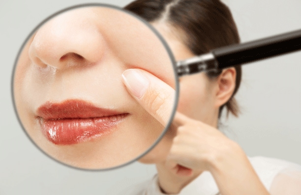 ほうれい線は加齢やたるみだけが原因ではありません！