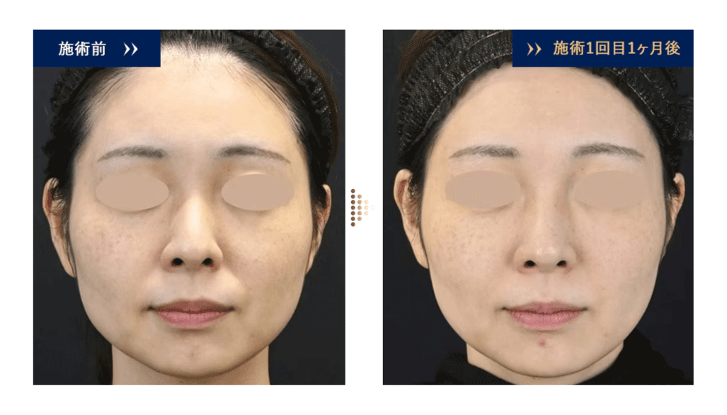 向いている年代・悩み