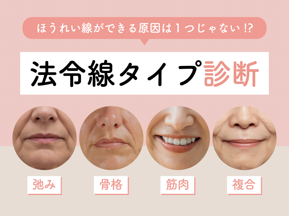【神戸】ほうれい線 原因と治療法をタイプ別に徹底解説｜西宮北口院