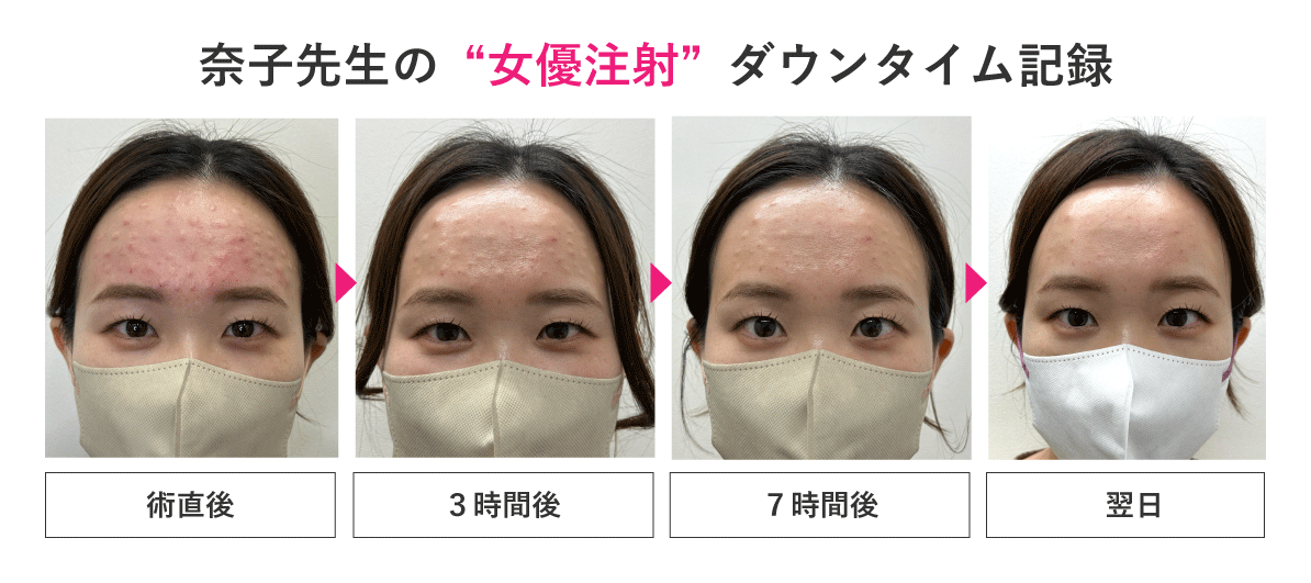 ダウンタイム・痛み・リスク