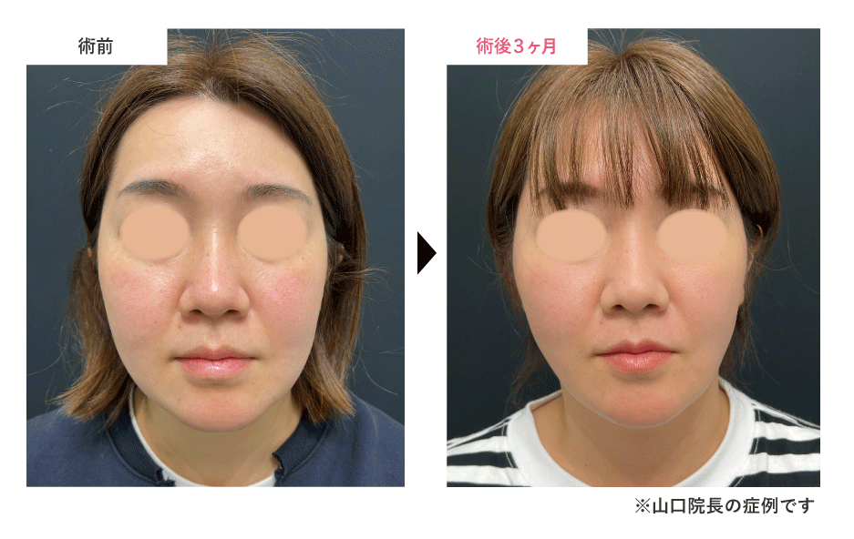 まずはこちらをお読みください。