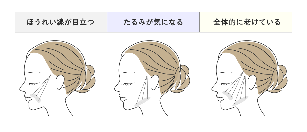 理由① 糸の入れ方がお客様それぞれ違う