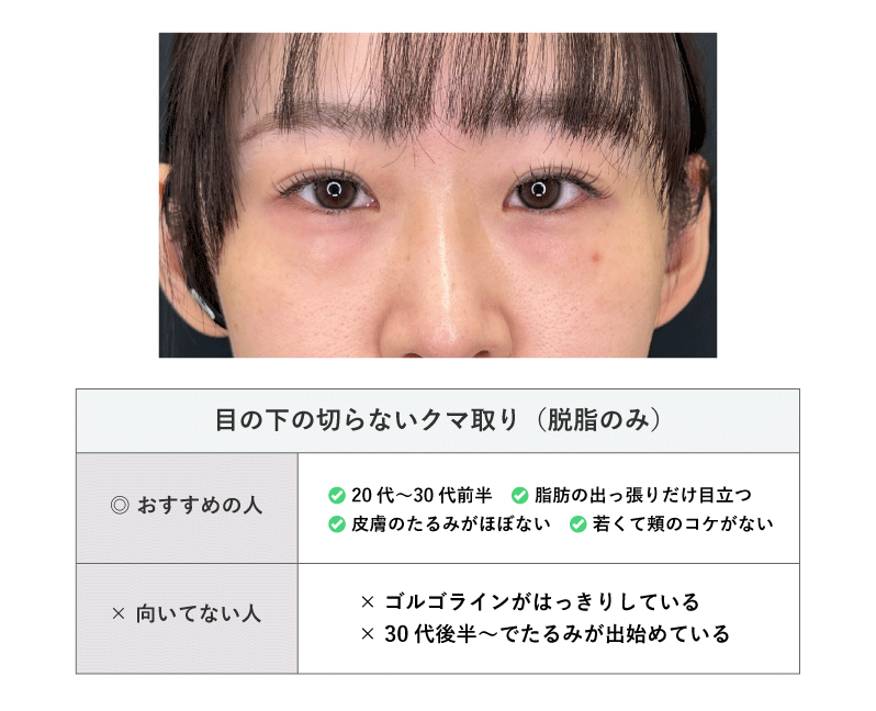 目の下の切らないクマ取り