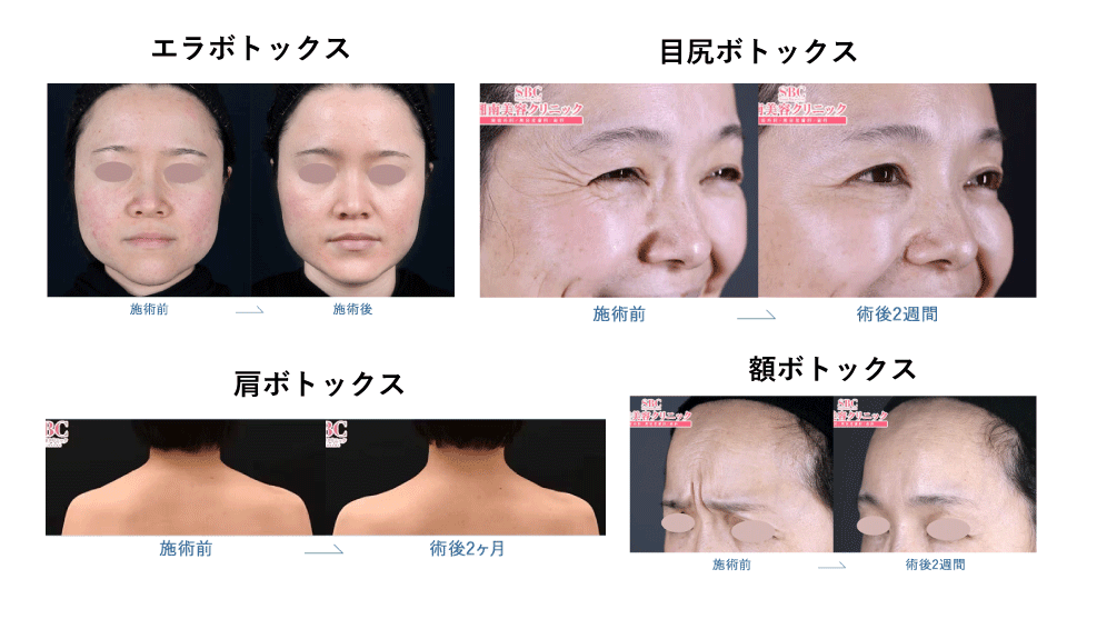 簡単注射で圧倒的な変化を...！