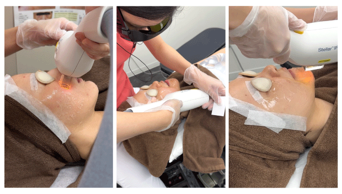 圧倒的な症例件数