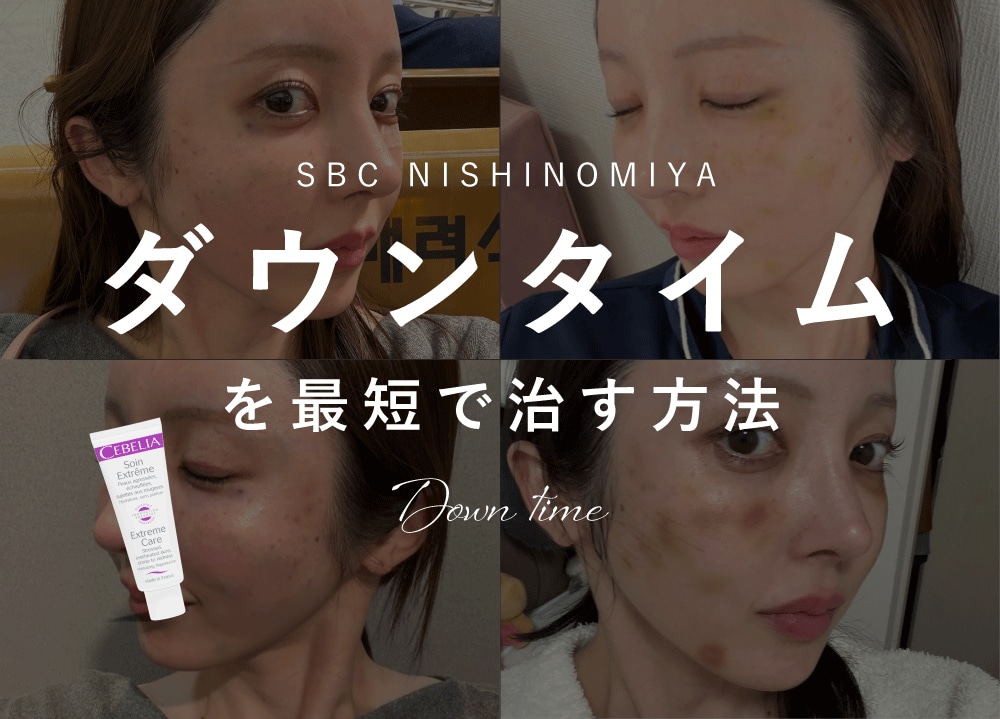 【症例有り】ダウンタイムを最短で治す方法｜内出血・腫れを早く引かせる正しいケアとは？