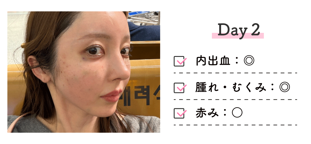 ■ 翌日（Day2）