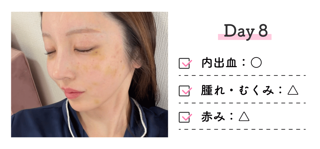 ■ 8日後（Day8）