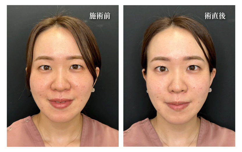 奈子先生も受けました！