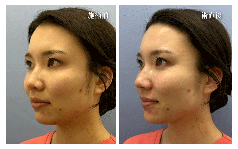 「毛穴・くすみ改善でワントーン明るいツヤ肌に」