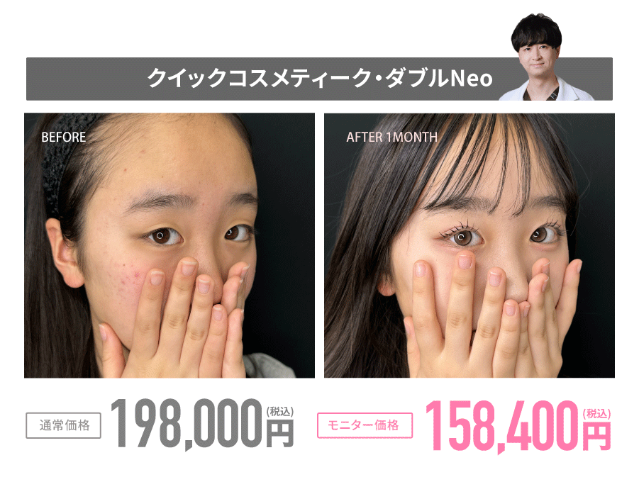 クイックコスメティーク法とは