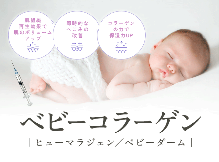 【2026年版】神戸・西宮でベビーコラーゲン注入ならSBC西宮北口院｜自然な若返り・クマ改善に人気の理由