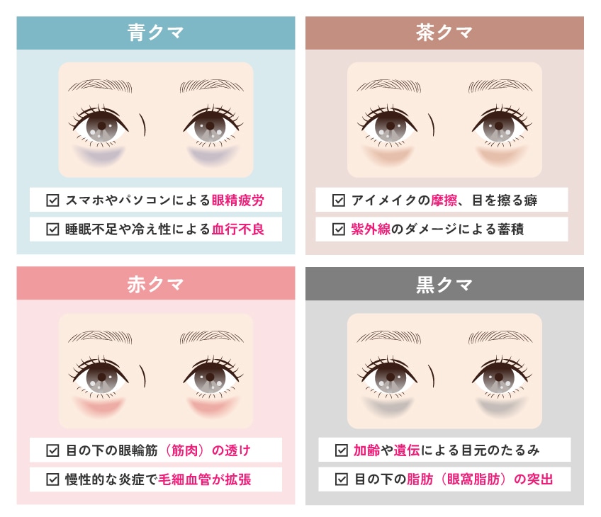タイプ別｜クマができた原因