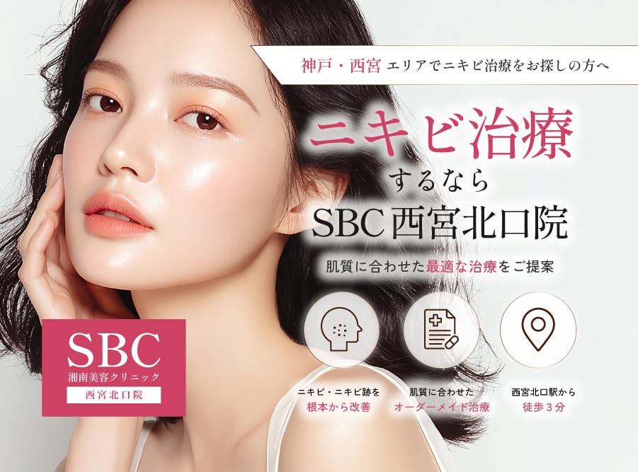 【神戸・西宮】ニキビ治療ならSBC西宮北口院｜肌質別おすすめ治療を医師が解説