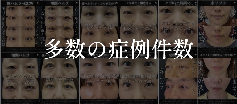 症例件数
